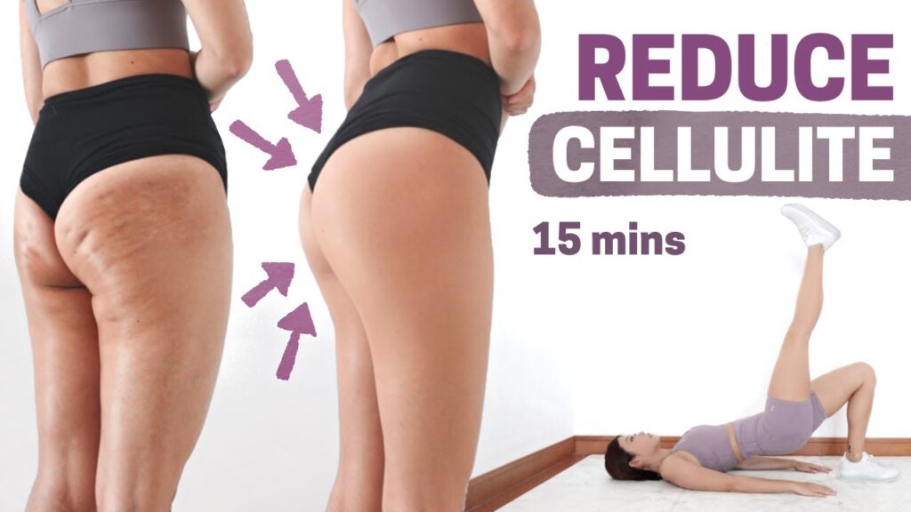 how can i reduce the appearance of cellulite 3
