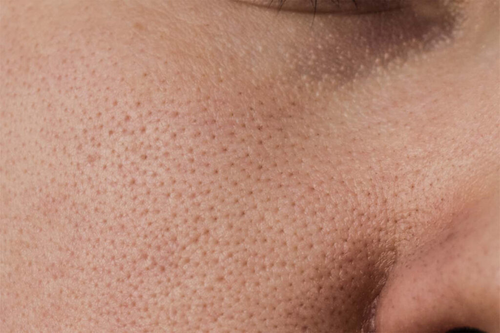 how can i reduce the appearance of my pores